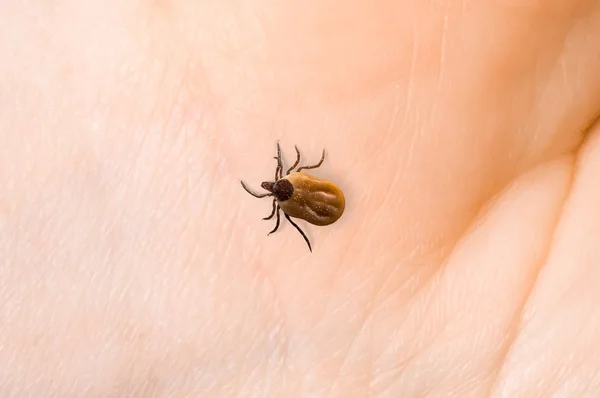 Tick Arrastra Sobre Piel Del Cuerpo Humano — Foto de Stock