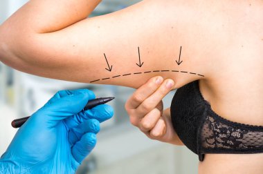 Plastik cerrahi doktor hasta kol - kozmetik cerrahi kavramı satırda çekmek