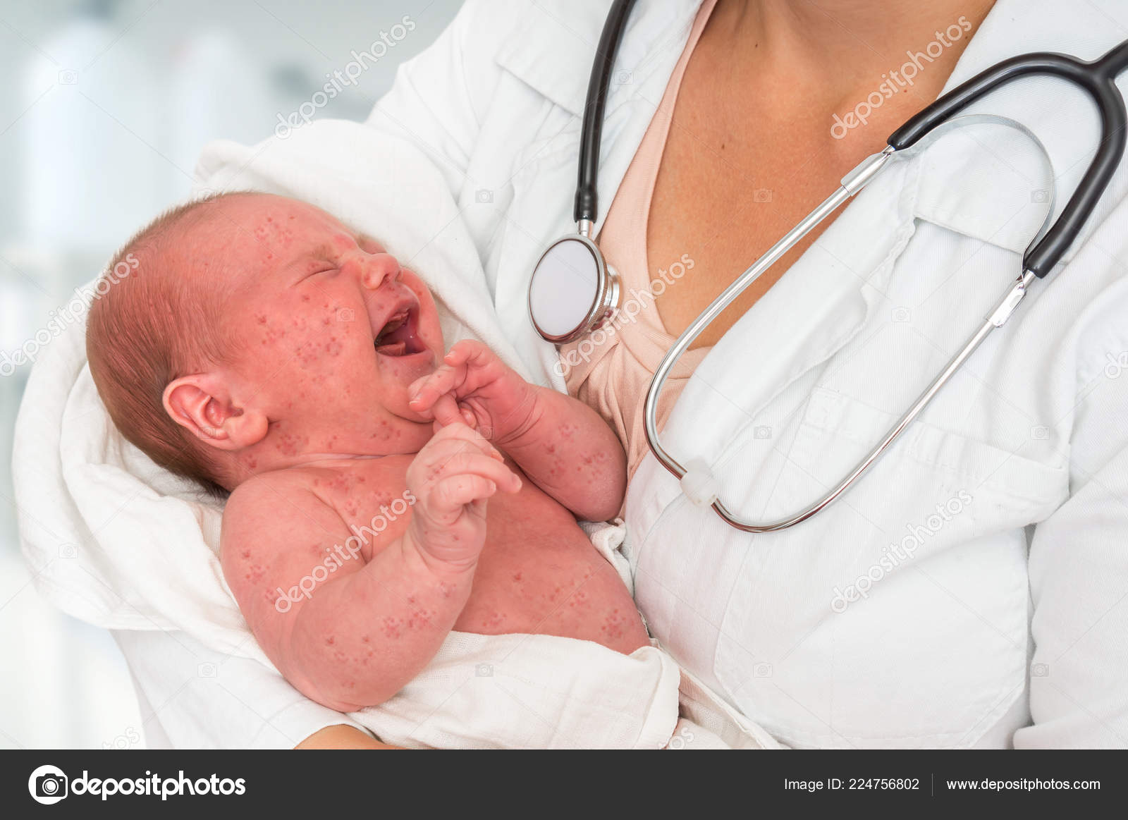 Doctor Stethoscope Holding Newborn Baby Which Sick Rubella Measles Stock Photo By C Andriano Cz Doctor Stethoscope Holding Newborn Baby Which Sick Rubella Measles Stock Photo By C Andriano Cz