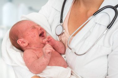 Doktor ile hasta kızamıkçık veya kızamık olan yeni doğmuş bir bebek tutan stetoskop
