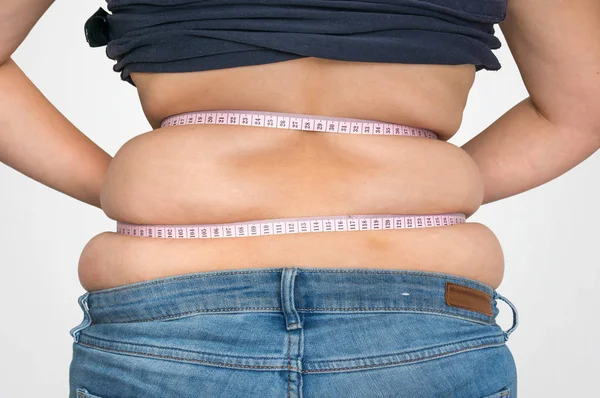 Obézní Ženy Páskou Měření Tuku Břiše Obezita Koncepce — Stock fotografie