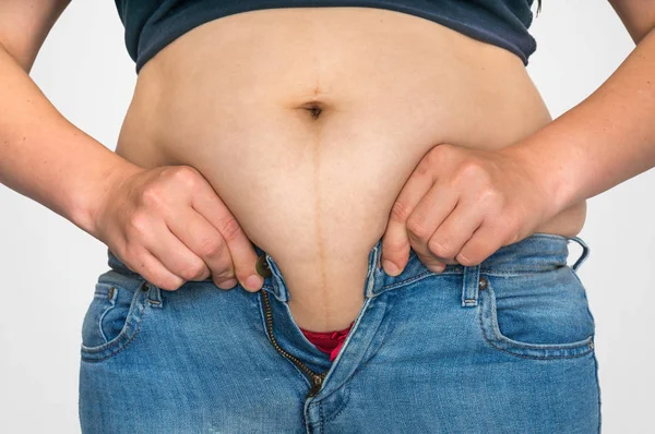 Надмірна Вага Жіночого Тіла Жиром Животі Концепція Надмірної Ваги Ожиріння — стокове фото