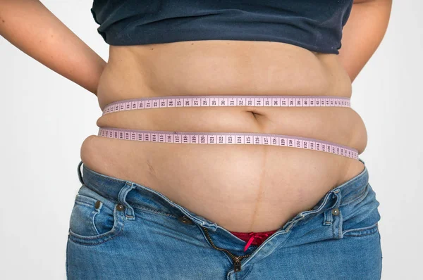 胖女人用胶带测量脂肪腹部 肥胖概念 — 图库照片