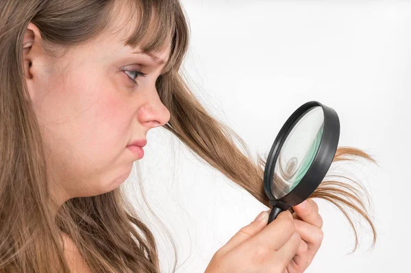 Vrouw Met Haar Problemen Broos Beschadigd Droog Bevuild Verlies Haar — Stockfoto