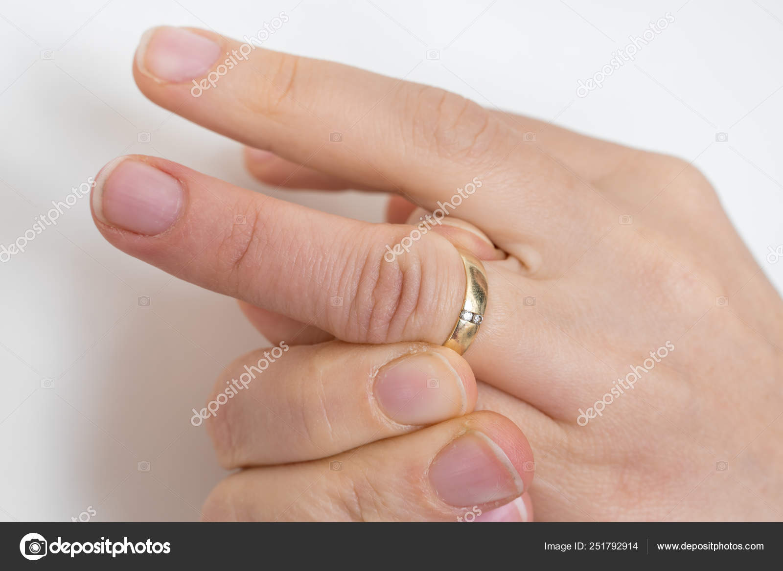 Woman cannot take off stuck wedding ring — Stock Photo