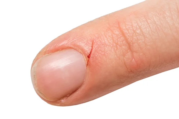 Gewonde vinger van een keukenmes met bloed — Stockfoto