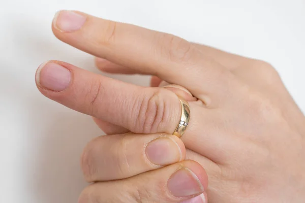 Женщина не может снять застрявшее обручальное кольцо — стоковое фото