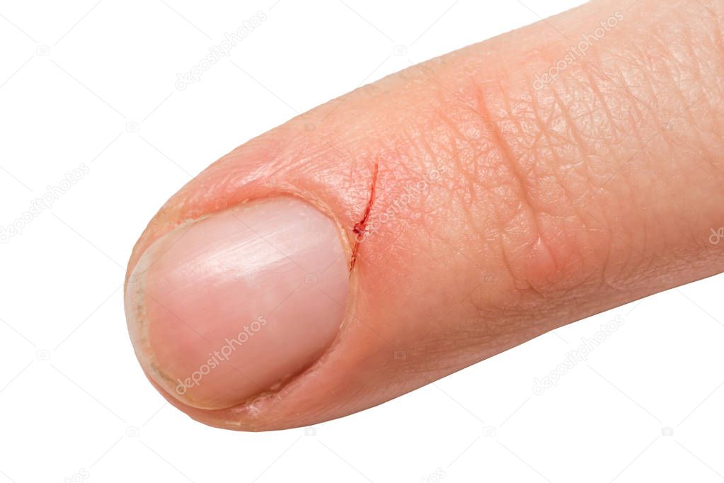 Injured finger from a kitchen knife with blood