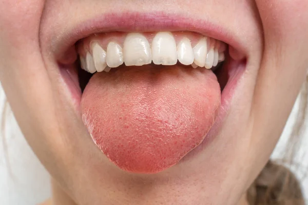 Woman with open mouth showing tongue