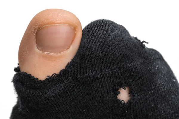 Sock with a hole and finger sticking out of them — Stock Photo, Image