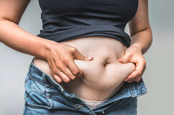 Übergewichtige Frau Körper mit Händen, die Bauchfett berühren — Stockfoto