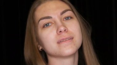 Pretty genç kız manken sorunlu cilt akne ve stüdyoda siyah arka plan üzerine uzun sarı saçları ile portresi