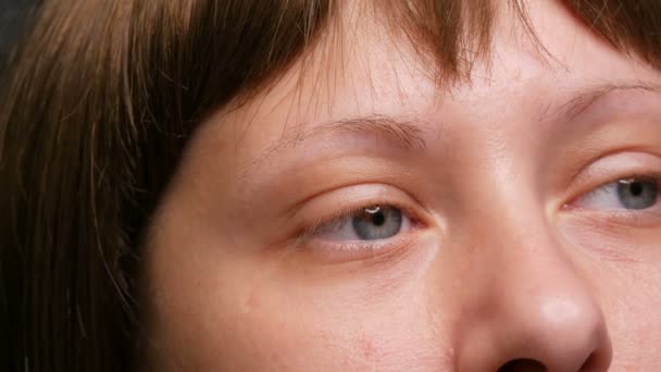 Het gezicht van jonge vrouw met blauwe ogen na chemotherapie die kanker heeft gehad. Onlangs gegroeid wenkbrauwen en wimpers. Korte pruik. — Stockvideo