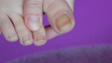 Aşırı büyümüş dişi, uzun kesilmiş ayak tırnakları.