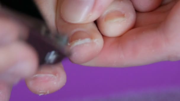 Woman cuts long overgrown toenails with steel clippers. Manicuring finger nails. Health and beauty concept. Finger tip getting nail cut close up. — Stock Video