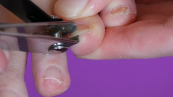 Женщина стрижет длинные заросшие ногти стальными ножницами. Маникюр ногтей. Концепция здоровья и красоты. Кончик пальца, чтобы ногти вырезать близко . — стоковое видео