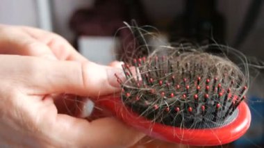 Kadın ellerini yakın mesafeden taradıktan sonra saçlarını tara. Tarakta bir sürü dökülmüş saç var. Saç dökülme sorunu, hormonal bozukluk, stres, diyet, kafa derisi ve saç ampülü hastalığı.