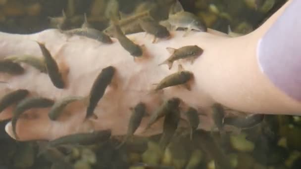 自然な剥離とマッサージでガラルファ魚足ケア。その過程で、再生を促進し、皮膚の弾力性を向上させる特別な酵素を分泌します。魚の皮膚の唯一の損傷領域を選択します。. — ストック動画