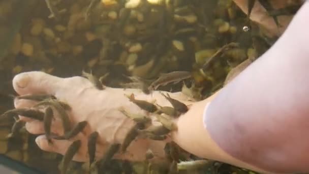 Garra Rufa perawatan ikan dengan mengupas alami dan pijat. Dalam prosesnya, mereka mengeluarkan enzim khusus yang mempromosikan regenerasi dan meningkatkan elastisitas kulit. Ikan hanya memilih area kulit yang rusak.. — Stok Video