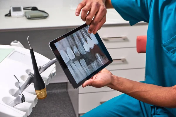 Dentista africano masculino explicando la radiografía al paciente — Foto de Stock