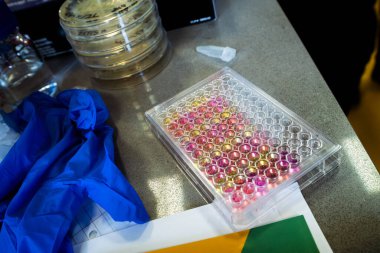 96 kuyu pipeti laboratuvar masasında renkli numunelerle dolu.