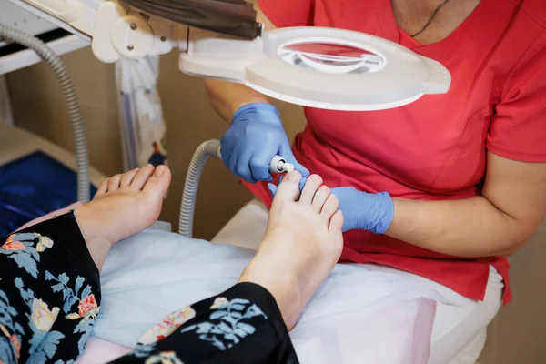 Leczenie Podology. Podiatrist leczenie paznokieć grzyb. Lekarz usunie modzele, Nagniotki i traktuje wrastających paznokci. Manicure sprzętu. — Zdjęcie stockowe