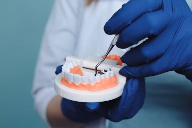 Diş hekimi randevusu, diş hekimliği aletleri ve diş hijyenisti kontrol konsepti. Diş modelleri takma dişler ve koyu gri üzerine stomatoloji aletleri. Düzenli kontroller oral sağlık için gereklidir