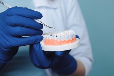 Diş hekimi randevusu, diş hekimliği aletleri ve diş hijyenisti kontrol konsepti. Diş modelleri takma dişler ve koyu gri üzerine stomatoloji aletleri. Düzenli kontroller oral sağlık için gereklidir