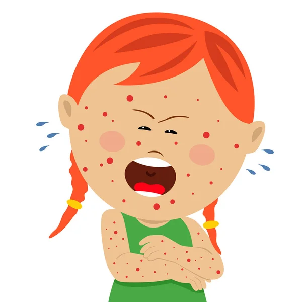 Little sick girl with chickenpox crying isolated on white — Stock Vector