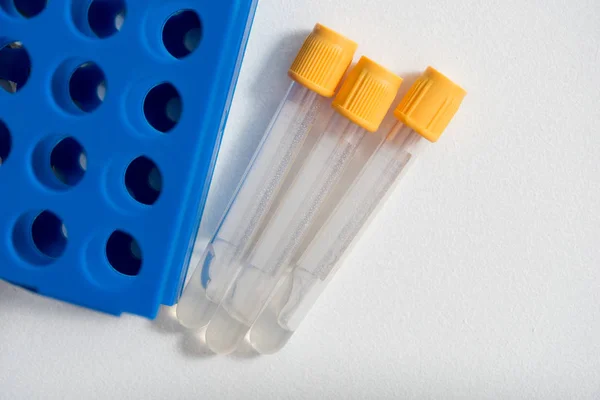 Bir Tripod Içinde Sarı Kapaklı Plastik Test Tüpleri Close Bilimsel — Stok fotoğraf