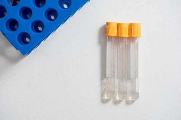 Close Plastic Test Tubes Yellow Lid Tripod Scientific Laboratory Preparation — Stock Photo, Image