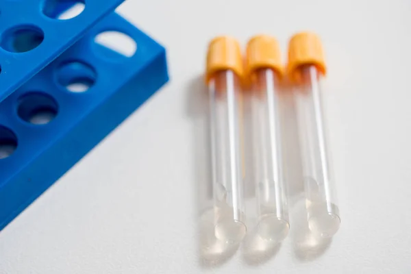 Close Plastic Test Tubes Yellow Lid Tripod Scientific Laboratory Preparation — Stock Photo, Image