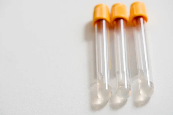 Μικροβιολογική Ιατρική Πιπέτα Ιατρική Σωλήνες Δοκιμής Στο Εργαστήριο Γενετικής — Φωτογραφία Αρχείου