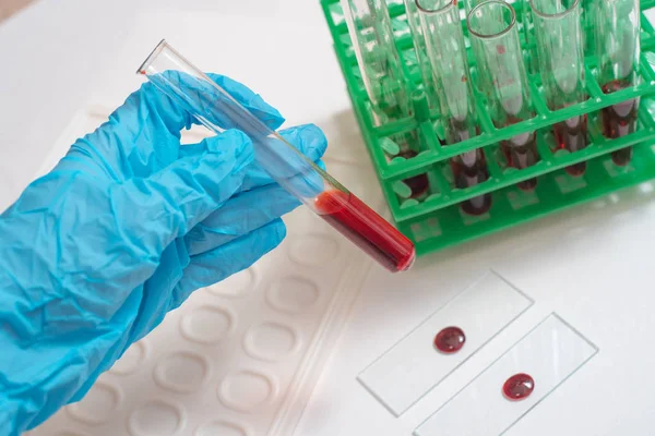 Scientist Working Blood Sample Laboratory Doctor Takes Test Tube — Stock Photo, Image