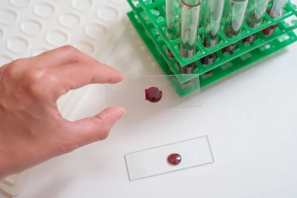 Scientist Working Blood Sample Laboratory Doctor Takes Test Tube — Stock Photo, Image