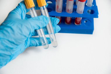 Doktor tüp kan bir tripod gelen ikinci grup ile ortaya çıkarır