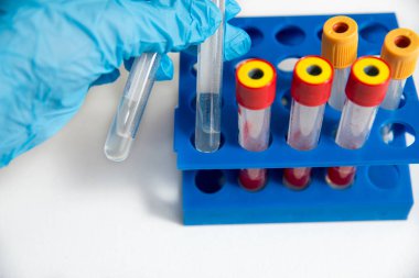 Doktor veya laboratuvar asistanı cam tıbbi test tüpleri, mavi bir eldiven, arka plan mavi bir tripod alır. beyaz bir arka plan üzerinde