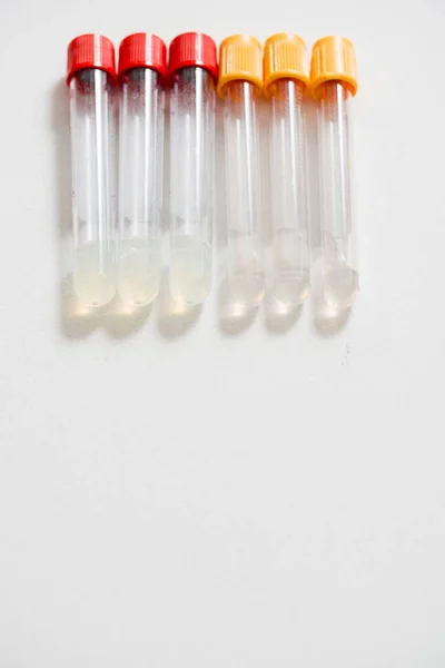 Microbiological Medical Pipette Medical Test Tubes Genetic Laboratory — Stock Photo, Image