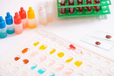 Laboratuvar pipet ile damla sıvı cam test tüpleri bilim araştırma laboratuarında bilimsel bir deney üzerinde.