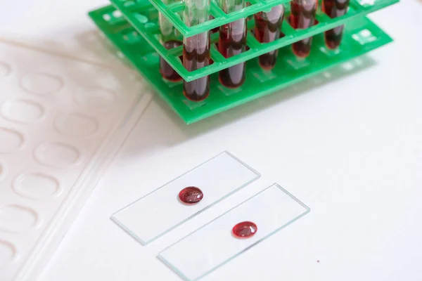 Laboratory Pipette Drop Liquid Glass Test Tubes Scientific Experiment Science — Stock Photo, Image