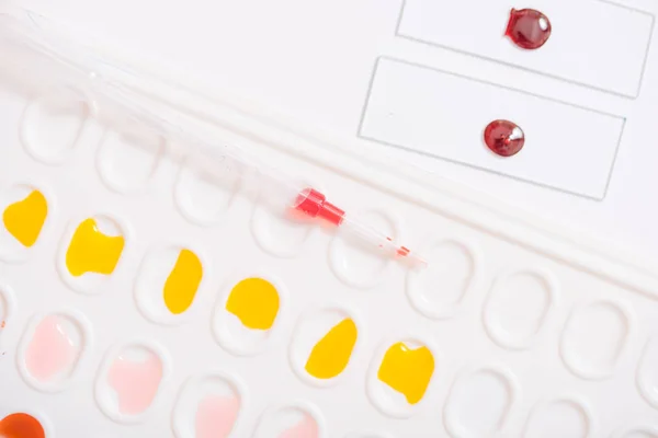 Laboratory Pipette Drop Liquid Glass Test Tubes Scientific Experiment Science — Stock Photo, Image