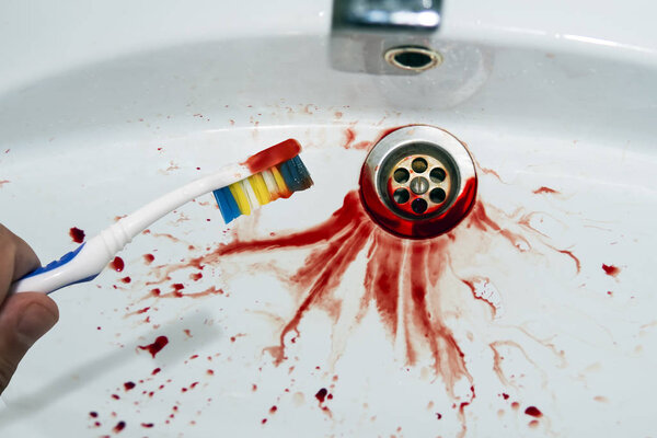 Close up of toothbrush in male hand with traces of blood on a blood-spitted sink background. Bloody tooth brush near the stained washbasin. Bleeding gum left the trace in bathroom sink. Mouth cavity