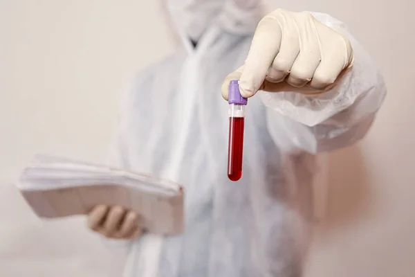 Hand with latex glove holding blood sample vial. A male laboratory assistant holding a red test tube with blood on a white background. Blood, DNA, and RNA testing. Search for viruses in the blood. S