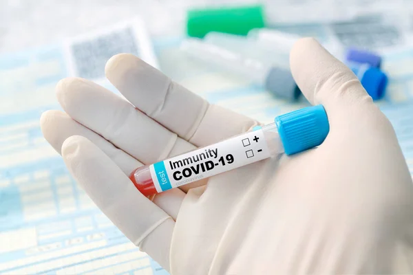 Тест Антитела Коронавирусной Инфекции Проверка Населения Наличие Иммунитета Ковиду Наличие — стоковое фото