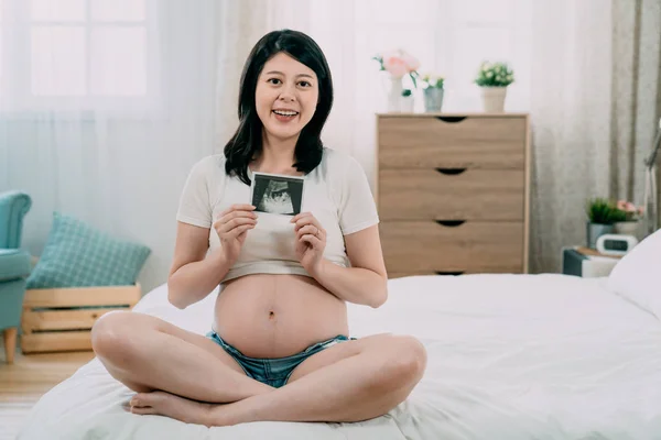 Maternidade mãe mostrando ultra-som foto da varredura — Fotografia de Stock