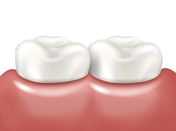 Dientes brillantes saludables en encías rosadas. Ilustración vectorial aislada sobre fondo blanco — Vector de stock