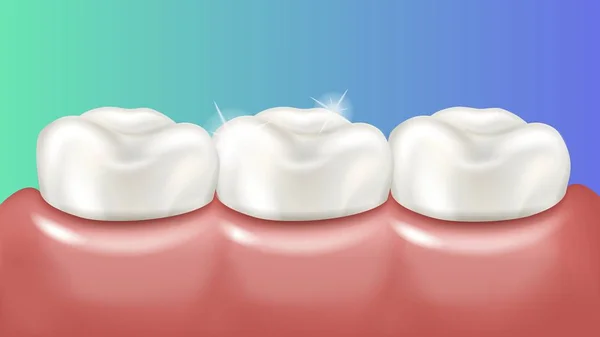 Gesunde, glänzende Zähne im rosa Zahnfleisch. Realistische medizinische Illustration — Stockvektor