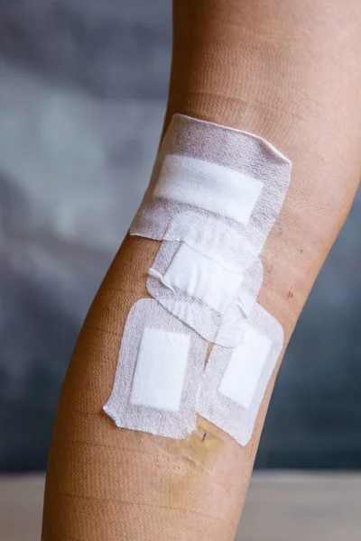 Bandages Womans Leg Varicose Vein Surgery Curative Treatment Esthetic Procedures — Stock Photo, Image