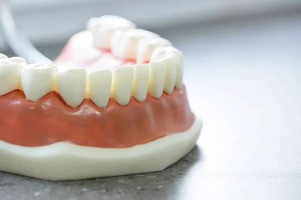 Модель зубів нижньої щелепи — стокове фото