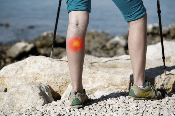 Woman with painful varicose veins on a leg with red dot effect. — 스톡 사진